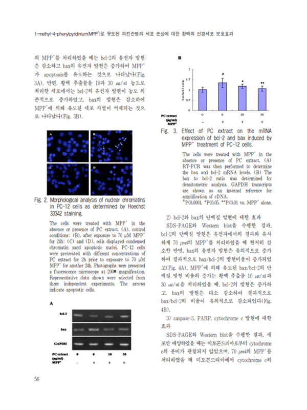 sub-parkinsons-disease-effect-img-10