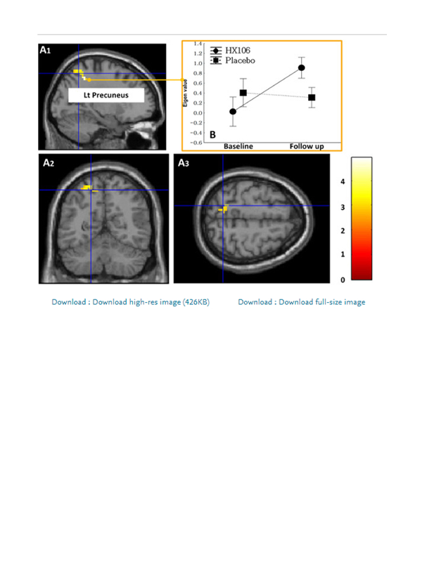 sub-young-adhd-effect-img-04